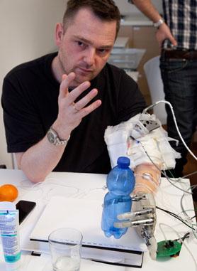 Kunstig hånd med ægte følsomhed testet af dansk patient 