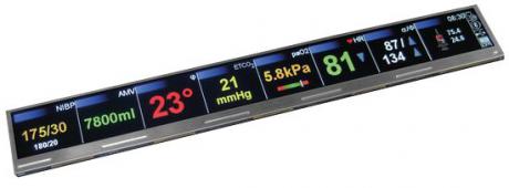 Unik implementering af kundespecifik TFT-display